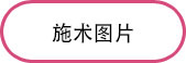 施术图片